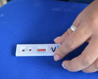 Armenia registra disminución en casos de VIH y fortalece tamizaje con más de 1.500 pruebas realizadas en lo que va de 2025