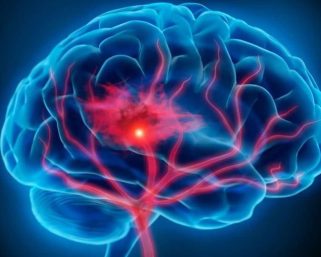 Un estudio señala que la pandemia aceleró el envejecimiento de los cerebros, independientemente de si se contrajo COVID o no