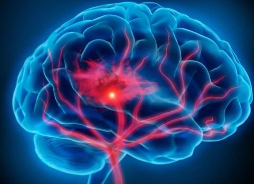 Un estudio señala que la pandemia aceleró el envejecimiento de los cerebros, independientemente de si se contrajo COVID o no