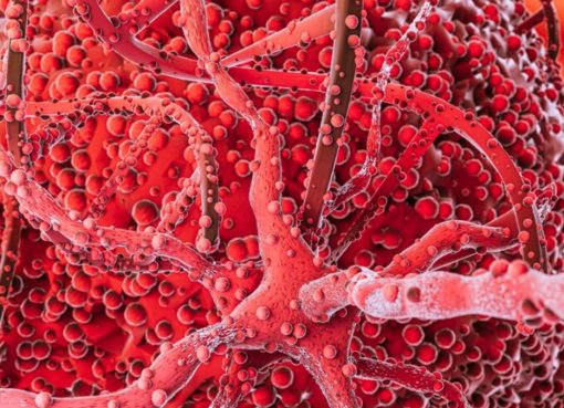 Una investigación concluyó que tener triglicéridos elevados puede contribuir a la aparición de aneurismas en la aorta abdominal