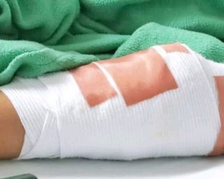 Aumentan a 7 los casos de personas quemadas por pólvora en el Quindío: Dos menores de edad