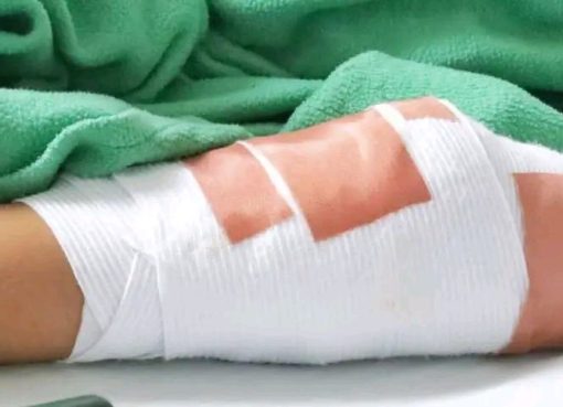 Aumentan a 7 los casos de personas quemadas por pólvora en el Quindío: Dos menores de edad