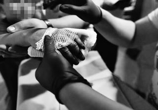 Cifra que preocupa: 13 quemados en el Quindío en lo que va del mes de diciembre