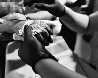 Cifra que preocupa: 13 quemados en el Quindío en lo que va del mes de diciembre