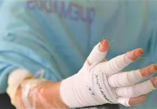 El Mal Inicio de Diciembre: Cuatro Adultos Quemados en Alborada de Armenia