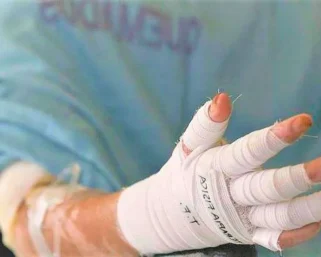 El Mal Inicio de Diciembre: Cuatro Adultos Quemados en Alborada de Armenia